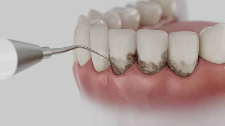 Reliable Dental Implants contractor in Siesta Acres, TX by Smile Center Dentistry